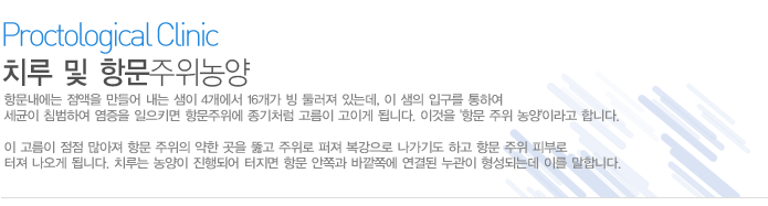 항문내에는 점액을 만들어 내는 샘이 4개에서 16개가 빙 둘러져 있는데, 이 샘의 입구를 통하여 세균이 침범하여 염증을 일으키면 항문주위에 종기처럼 고름이 고이게 됩니다. 이것을 '항문 주위 농양'이라고 합니다.

이 고름이 점점 많아져 항문 주위의 약한 곳을 뚫고 주위로 퍼져 복강으로 나가기도 하고 항문 주위 피부로 터져 나오게 됩니다. 치루는 농양이 진행되어 터지면 항문 안쪽과 바깥쪽에 연결된 누관이 형성되는데 이를 말합니다.   