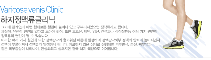 하지 정맥류란 무엇인가?
 
크기에 관계없이 어떤 형태로든 혈관이 늘어나 있고 구부러져있으면 정맥류라고 합니다.
체질적, 유전적 원인도 있다고 보아야 하며, 또한 호르몬, 비만, 임신, 간경화나 심장질환등 여러 가지 원인이 정맥류의 원인이 될 수 있습니다.
이러한 여러 가지 원인에 의한 정맥판막의 헐거워짐 때문에 발생하며 정맥판막하부 정맥의 압력이 높아지면서 정맥이 부풀어져서 정맥류가 발생하게 됩니다.
치료하지 않은 상태로 진행되면 피부변색, 습진, 피부염 과 같은 피부증상이 나타나며, 만성화되고 심해지면 결국 하지 궤양으로 이어집니다.