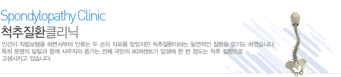 척추 질환 원인 
인간이 직립보행을 하면서부터 인류는 두 손의 자유를 얻었지만 척추질환이라는 필연적인 질병을 얻기도 하였습니다. 특히 문명의 발달과 함께 사무직의 증가는 전체 국민의 80퍼센트가 일생에 한 번 정도는 척추 질환으로 고생시키고 있습니다.   